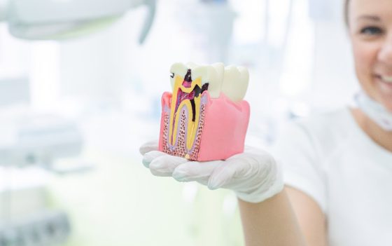 Anatomie eines Zahnmodells, Konzept eines Zahnarztquerschnitts für die Ausbildung.