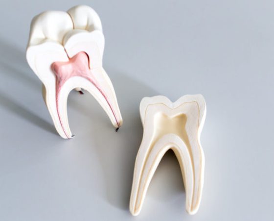 Zahnmodell für die Ausbildung im Labor.