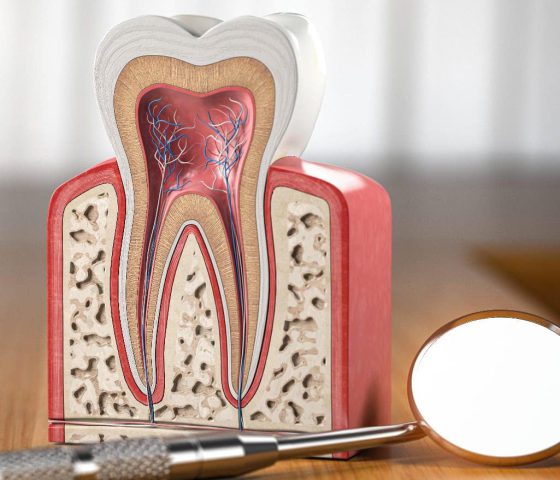 Zahnmodellquerschnitt mit Zahnspiegelwerkzeug